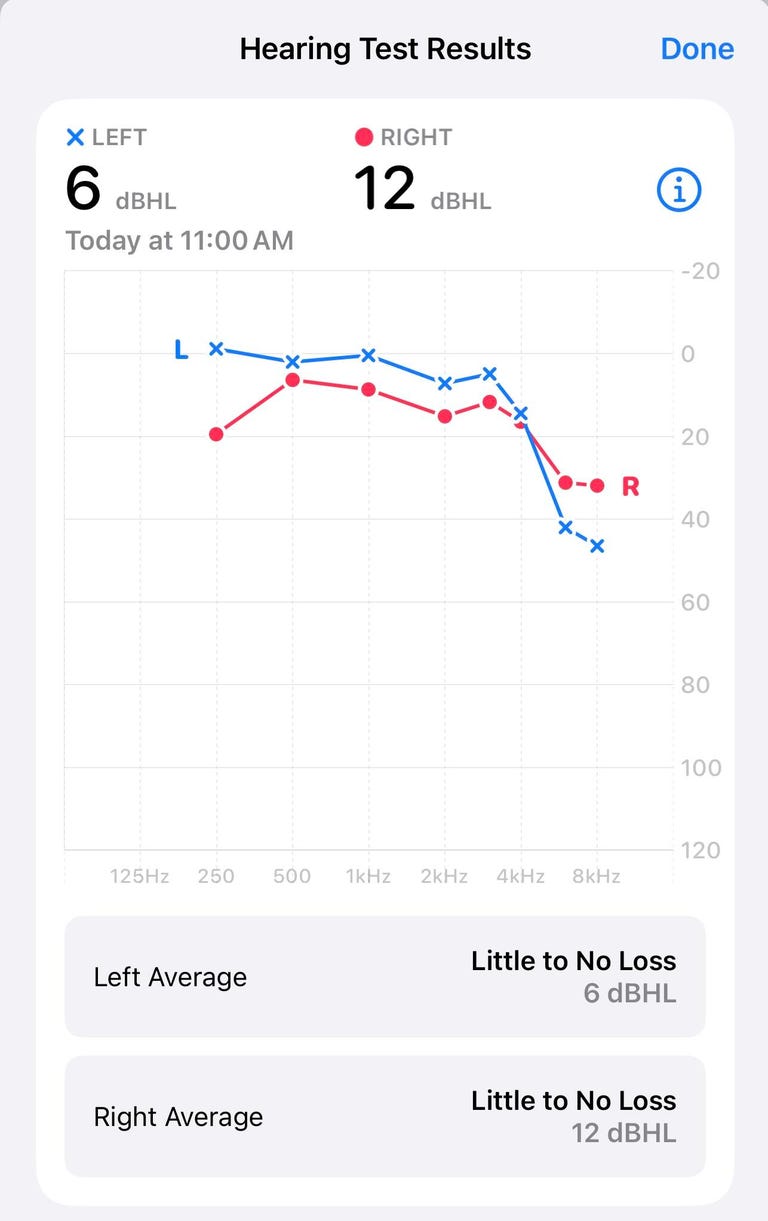 A screenshot of hearing test results from AirPods Pro 2.